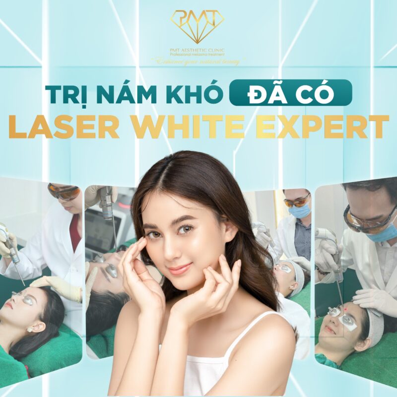 Cách trị nám da an toàn với Hybrid Pico Laser